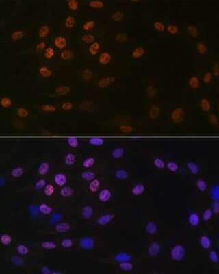 Immunocytochemistry/ Immunofluorescence: KAT1 Antibody (7U2O3) [NBP3-16412]