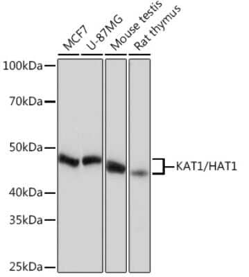 Western Blot: KAT1 Antibody (7U2O3) [NBP3-16412]