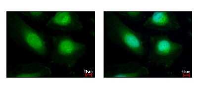 Immunocytochemistry/ Immunofluorescence: KAT1 Antibody [NBP2-14976]