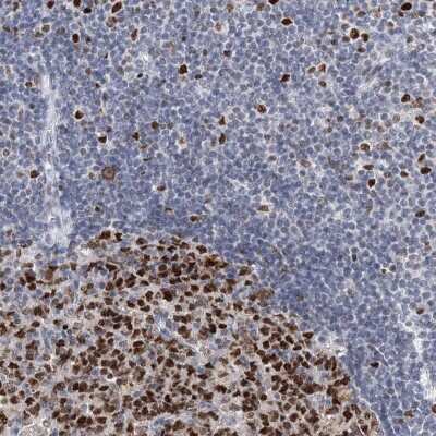 Immunohistochemistry-Paraffin: KAT1 Antibody [NBP1-87835]