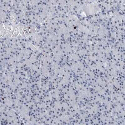 Immunohistochemistry-Paraffin: KAT1 Antibody [NBP1-87835]