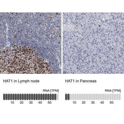 Immunohistochemistry-Paraffin: KAT1 Antibody [NBP1-87835]