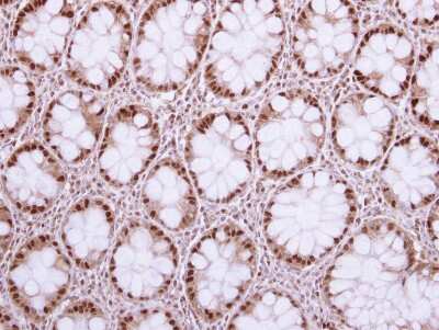 Immunohistochemistry-Paraffin: KAT1 Antibody [NBP2-14976]