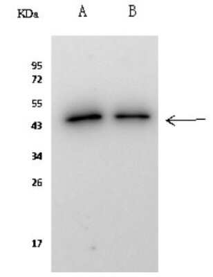 Immunoprecipitation: KAT1 Antibody [NBP2-98804]