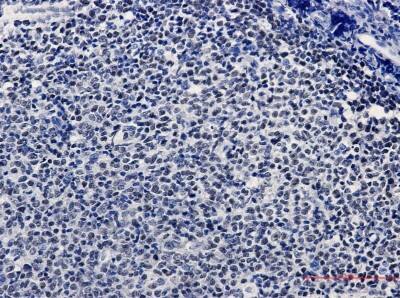 Immunohistochemistry-Paraffin: KAT1 Antibody (S04-3G4) [NBP3-19521]