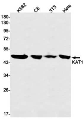 Western Blot: KAT1 Antibody (S04-3G4) [NBP3-19521]