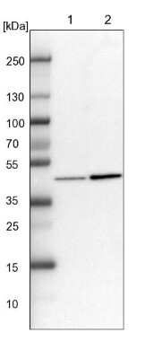 Western Blot: KAT1 Antibody [NBP1-87835]