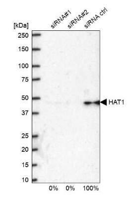 Western Blot: KAT1 Antibody [NBP1-87835]