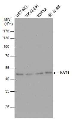 Western Blot: KAT1 Antibody [NBP2-14976]