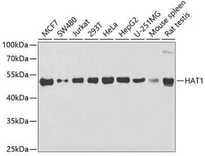 Western Blot: KAT1 AntibodyBSA Free [NBP3-03604]