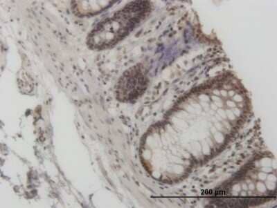 Immunohistochemistry-Paraffin: KAT2A/GCN5 Antibody (3F8) [H00002648-M06]