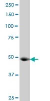 Western Blot: KAT2A/GCN5 Antibody (3F8) [H00002648-M06]