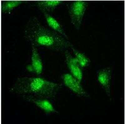 Immunocytochemistry/ Immunofluorescence: KAT2A/GCN5 Antibody (3G13) - BSA Free [NBP1-48593]
