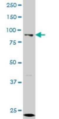 Western Blot: KAT2A/GCN5 Antibody (4D3) [H00002648-M01]