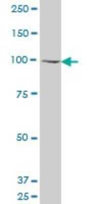 Western Blot: KAT2A/GCN5 Antibody (4F9) [H00002648-M03]