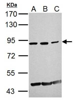 Western Blot: KAT2A/GCN5 Antibody [NBP2-17017]