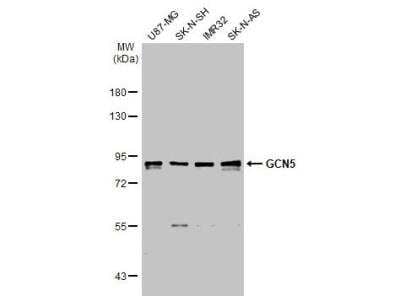 Western Blot: KAT2A/GCN5 Antibody [NBP2-17017]