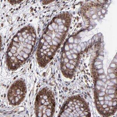 Immunohistochemistry-Paraffin: KAT3B/p300 Antibody [NBP1-87694]