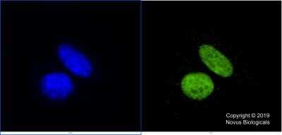 Immunocytochemistry/ Immunofluorescence: KAT3B/p300 Antibody (RW128) - Azide and BSA Free [NBP2-80819]