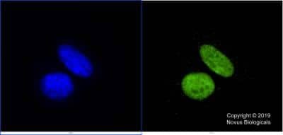 Immunocytochemistry/ Immunofluorescence: KAT3B/p300 Antibody (RW128) - BSA Free [NB100-507]