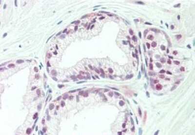 Immunohistochemistry: KAT4/TBP Associated Factor 1 Antibody [NBP1-77847]