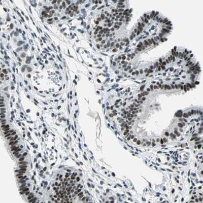 Immunohistochemistry-Paraffin: KAT6B-MORF Antibody [NBP1-92036]