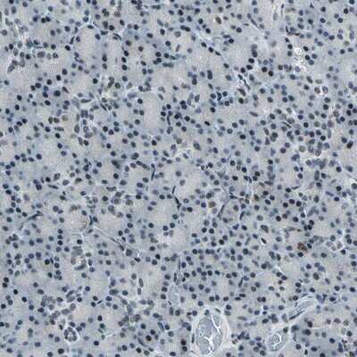 Immunohistochemistry-Paraffin: KAT6B-MORF Antibody [NBP1-92036]