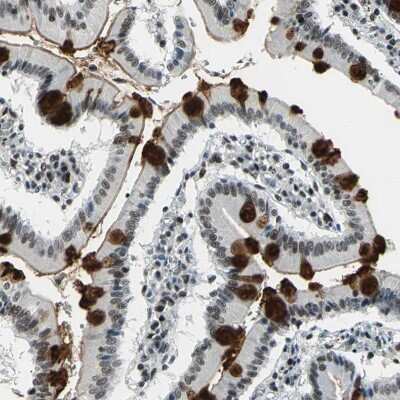 Immunohistochemistry-Paraffin: KAT6B-MORF Antibody [NBP1-92036]