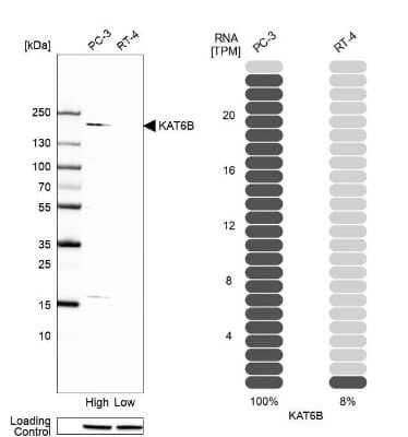 Western Blot: KAT6B-MORF Antibody [NBP1-92036]