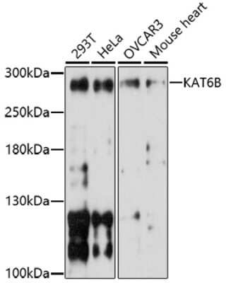 Western Blot: KAT6B-MORF AntibodyAzide and BSA Free [NBP3-02990]