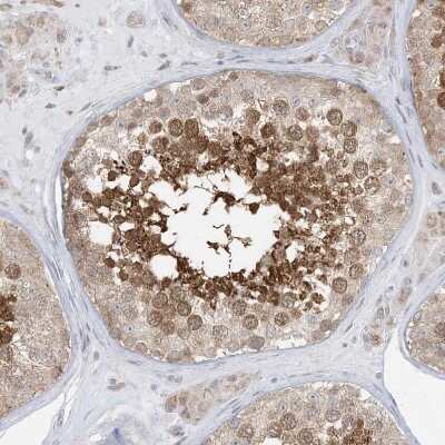 Immunohistochemistry-Paraffin: KAT8 regulatory NSL3 Antibody [NBP1-83875]