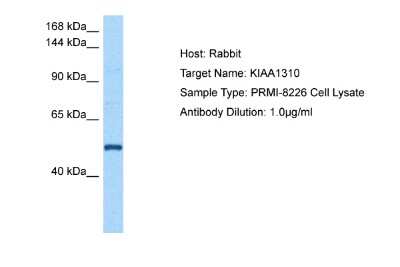 Western Blot: KAT8 regulatory NSL3 Antibody [NBP2-87656]