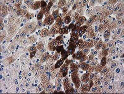 Immunohistochemistry-Paraffin: KATNAL1 Antibody (OTI1A7) [NBP2-03555]