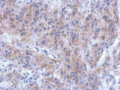 Immunohistochemistry-Paraffin: KATNAL1 Antibody [NBP2-17021]