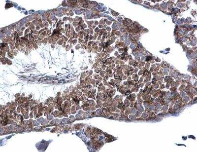 Immunohistochemistry-Paraffin: KATNAL1 Antibody [NBP2-17021]