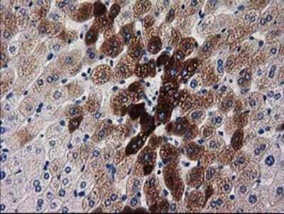 Immunohistochemistry: KATNAL1 Antibody (OTI1A7) - Azide and BSA Free [NBP2-72254]