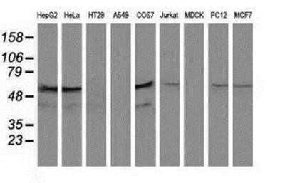 Western Blot: KATNAL1 Antibody (OTI1A7)Azide and BSA Free [NBP2-72254]
