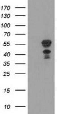 Western Blot: KATNAL1 Antibody (OTI1A7)Azide and BSA Free [NBP2-72254]