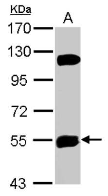 Western Blot: KATNAL1 Antibody [NBP2-17021]