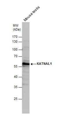 Western Blot: KATNAL1 Antibody [NBP2-17021]