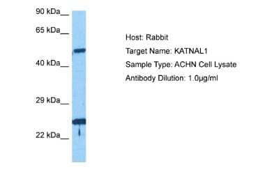 Western Blot: KATNAL1 Antibody [NBP2-86689]