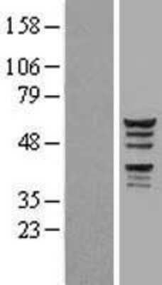 Western Blot: KATNAL1 Overexpression Lysate [NBL1-12127]