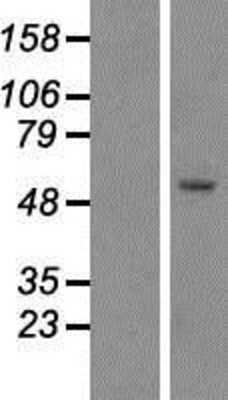 Western Blot: KATNAL1 Overexpression Lysate [NBP2-09147]