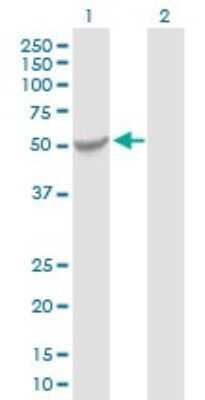 Western Blot: KATNAL2 Antibody [H00083473-B01P]