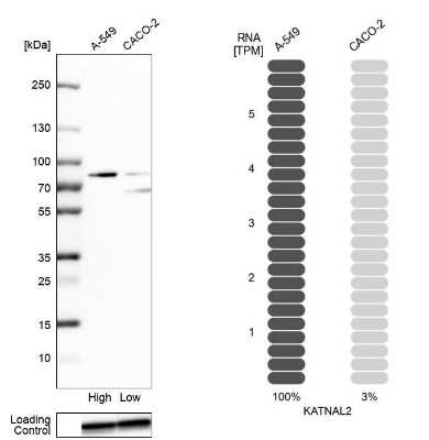 Western Blot: KATNAL2 Antibody [NBP2-30452]