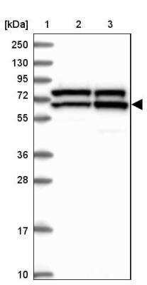 Western Blot: KATNAL2 Antibody [NBP2-30844]