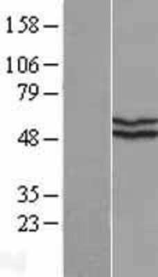 Western Blot: KATNAL2 Overexpression Lysate [NBL1-12129]