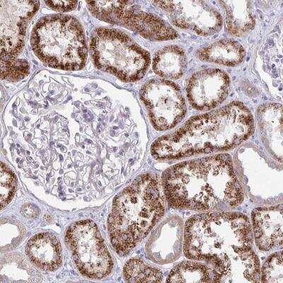Immunohistochemistry-Paraffin: KATNBL1 Antibody [NBP2-31859]