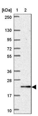 Western Blot: KATNBL1 Antibody [NBP2-31859]