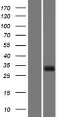 Western Blot: IGFBP-rP10/KAZALD1 Overexpression Lysate [NBP2-06155]